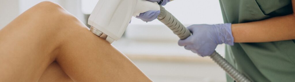 Epilazione laser